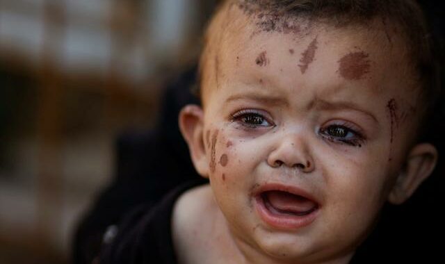 Gaza baby Reem Abu Hayya survives Israeli airstrike that kills her entire immediate family